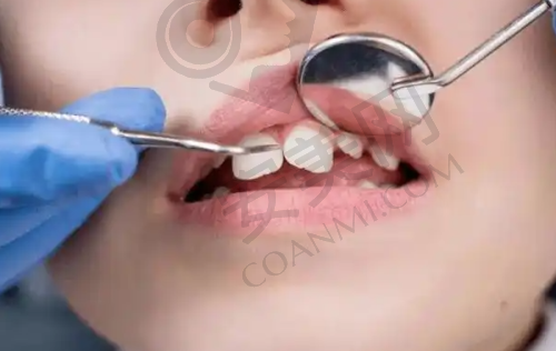 就诊过程是怎样的？复杂吗？