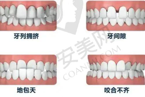 在长春爱馨口腔医院进行隐形牙齿矫正的服务体验怎么样？
