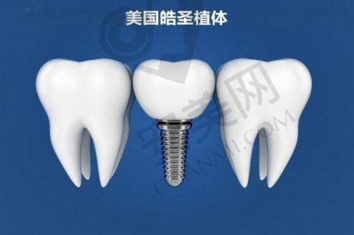 性价比高：技术服务与价格的理想平衡