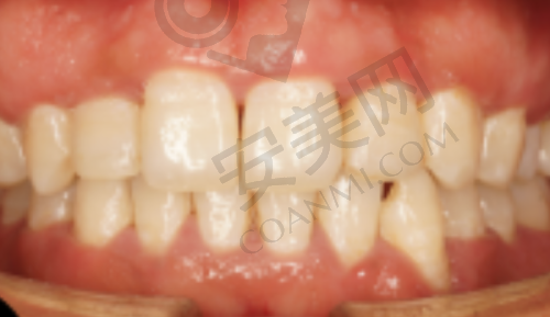 总结