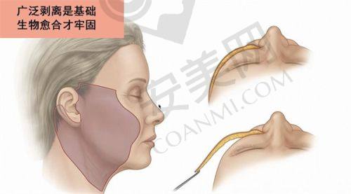 个性化服务——满足患者的独特需求