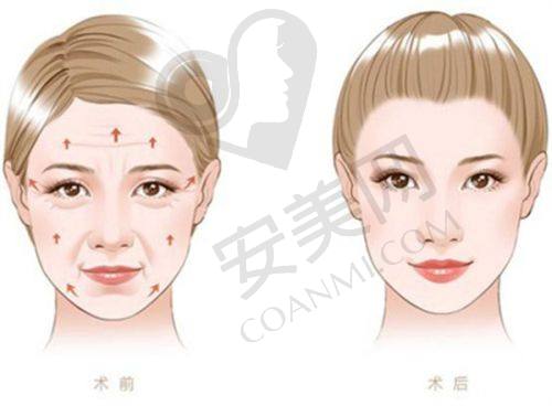 北京加减美在拉皮手术的服务质量方面表现如何？