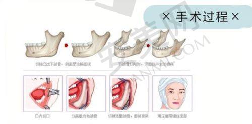 丰富经验：个性化治疗方案的保护
