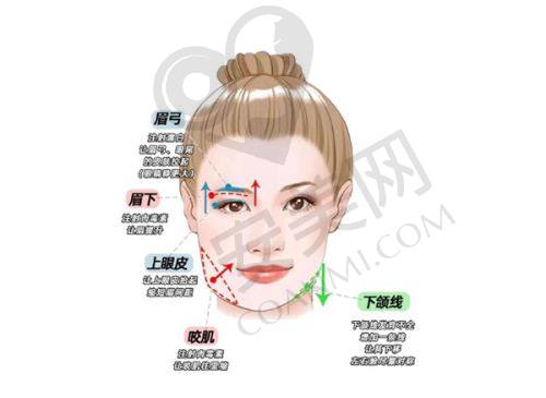 选择西安艺星宋蔚医生6D睑緣切开明星眼的理由有哪些？
