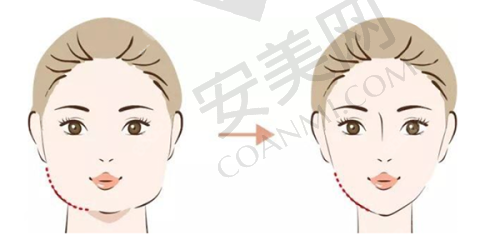 术后需要注意什么？