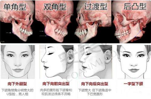 兰州臻韩杜福生医生面部年轻化怎么样？