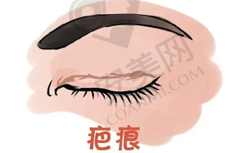 北京黄寅守面部拉皮术后成效能维持多久？