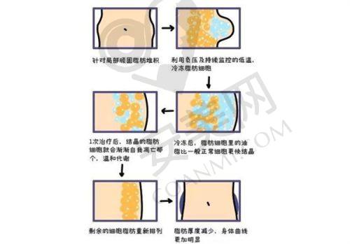 上海华美打玻尿酸塑轮廓，医院环境怎么样？