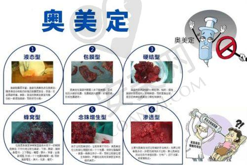 五、上海曼领医疗美容医院预约挂号流程：