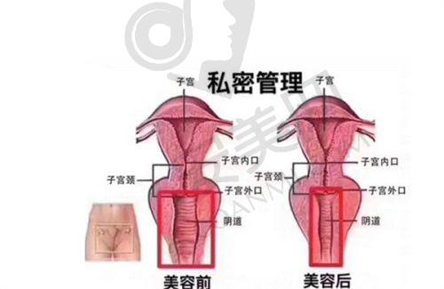 上海华美医院嗨体去颈纹的成功实例多吗？