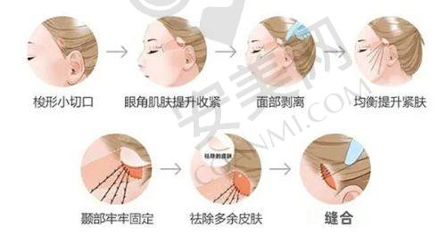 如何通过预约电话成功预约？