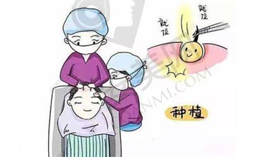 北京碧莲盛植发的医生团队水平怎样？