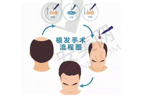北京碧莲盛植发的环境和设施怎么样？
