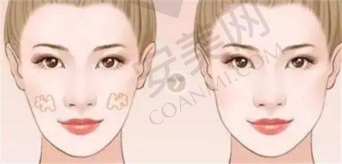 上海华美幼态脸打造医生技术如何？