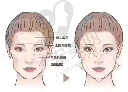 1、上海曼领孙美庆医生怎么样？