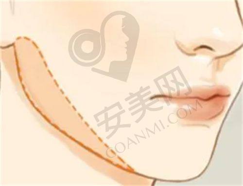 黄寅守和杨俊的成功实例成效如何对比？