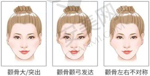 南京友谊整形医院双眼皮修复术后修复怎么样？