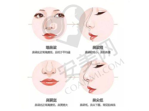 如何在西安艺星选择适合自己的眼综合医生？