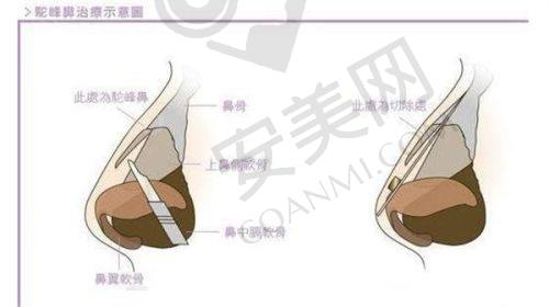 结语：选择健丽医美，告别眼袋困扰