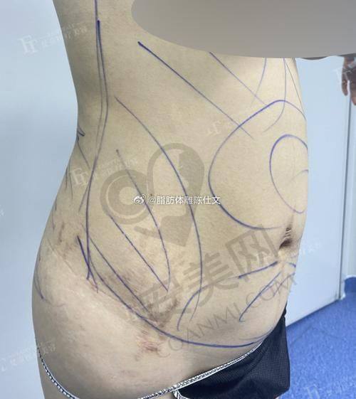 杨宇梓医生有何独特之处？