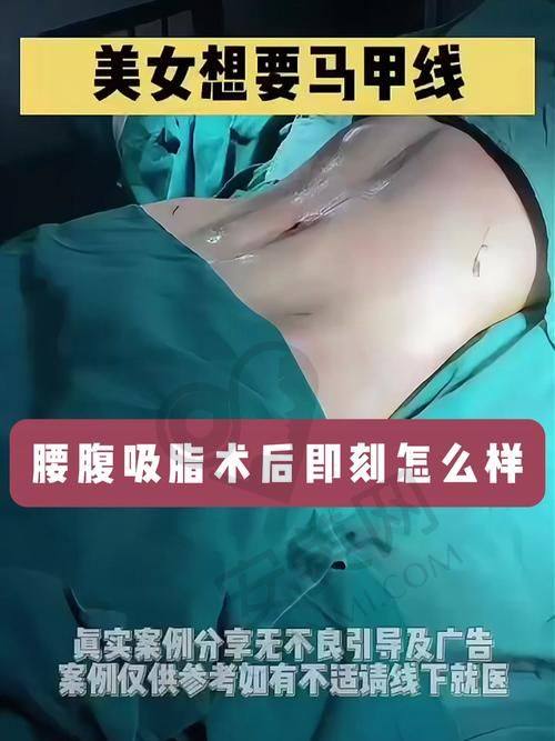 术后需要注意什么？