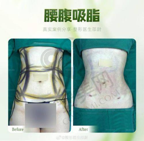 患者的真实实例分享