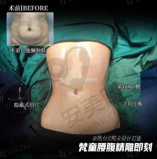 如何选择适合自己的医美机构和医生？