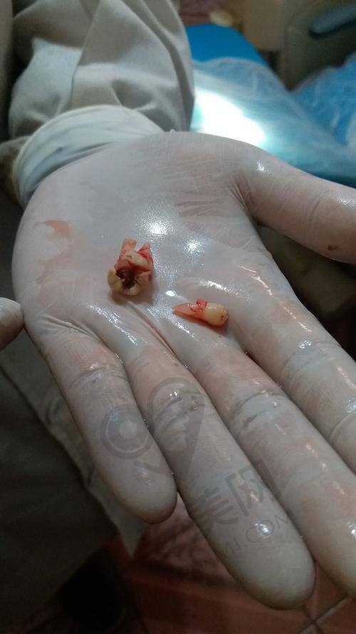 到院后是怎样的就诊流程呢？