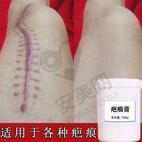 选择医院的注意事项