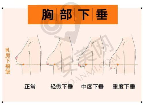 西安米兰柏羽整形医院