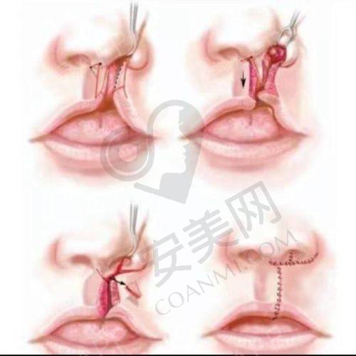 排名前 5 的西安医美整形医院详细介绍