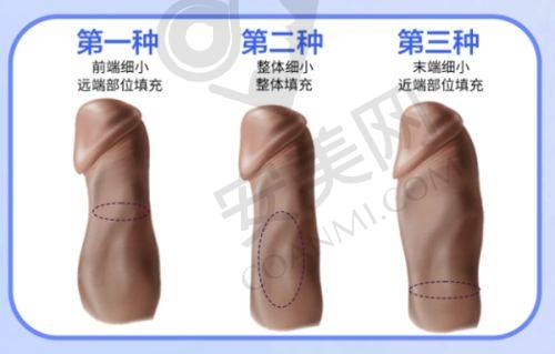 保定驭颜医疗美容门诊部预约挂号流程：