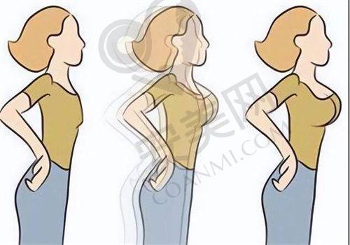 如何选择适合自己的东莞爱思特医疗美容医生？