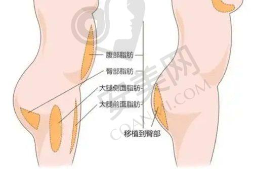 2、广州壹加壹李明院长擅长项目
