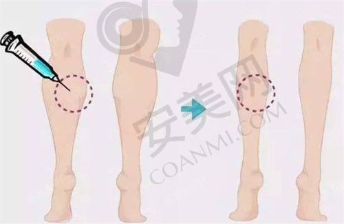 3、南京美莱吕桦医生诊疗技术怎么样？