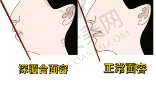 宁波余姚冠扬口腔医院的消毒措施严格吗？