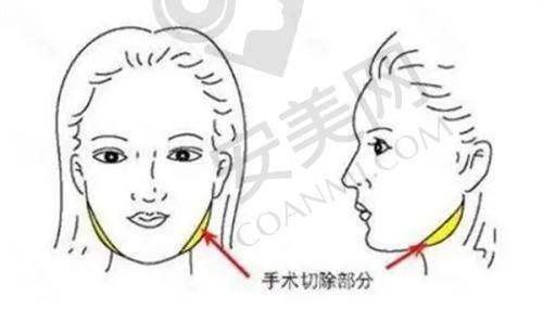 深圳非凡医院的成功实例能证明好口碑吗？