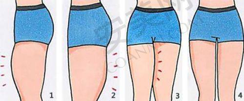 2、南京美莱吕桦医生擅长项目：