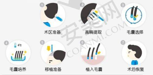 如何获取正确的成都大麦微针植发价格表？