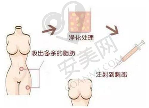 淄博阳光整形美容医院：老牌医美机构的精细之美