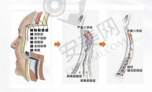 慈溪巨尚医疗美容诊所预约挂号流程：