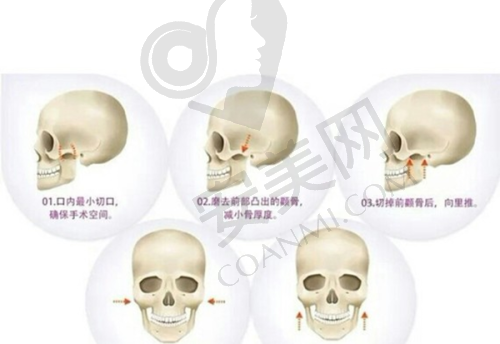 深圳非凡医院的负面评价影响好口碑吗？