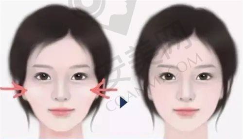 慈溪巨尚医疗美容诊所患者评价：