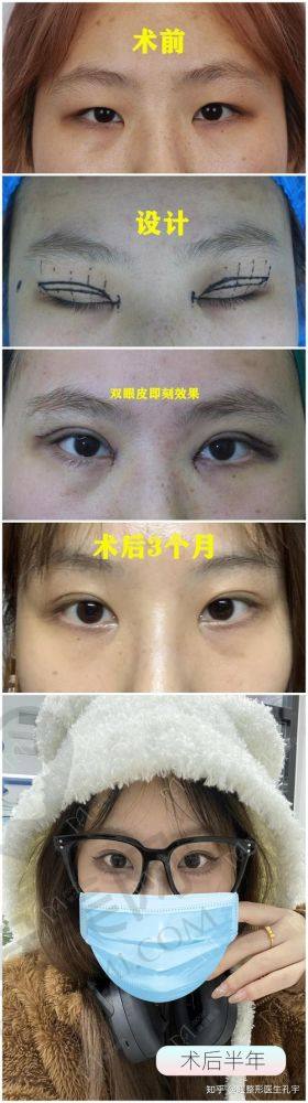 总结