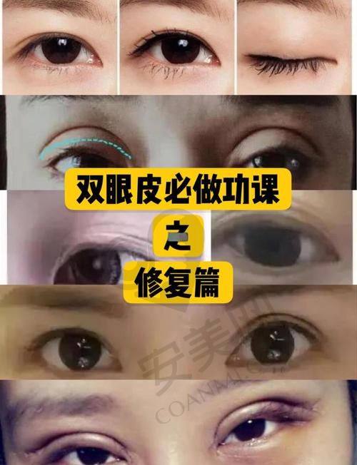 深圳非凡整形医院与其他整形医院相比有什么独特之处？