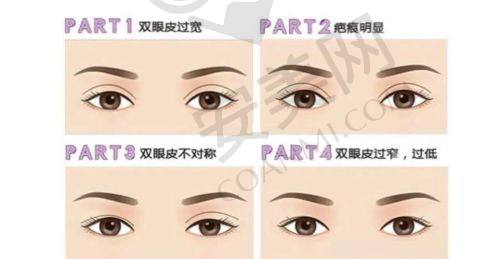 深圳非凡整形医院双眼皮价格为何是11800元起？