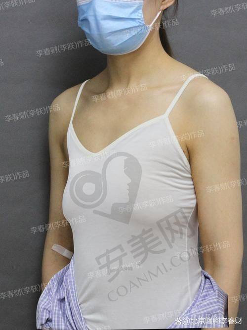 术后成效和感受如何？