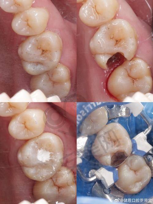 达州绮云口腔的收费合理吗？