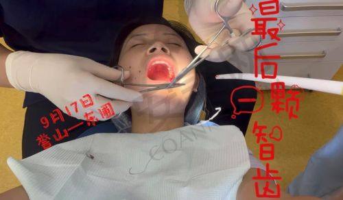 在汕尾陆丰莱恩口腔拔智齿的流程是怎样的？