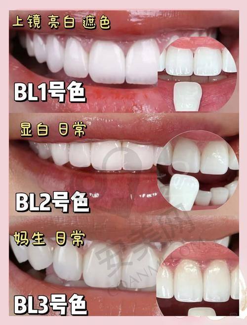 杭州贝佳齿科李佳医生擅长项目